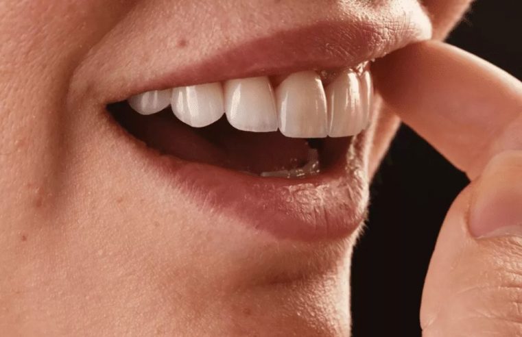Taking Care Of Your Teeth With Veneers