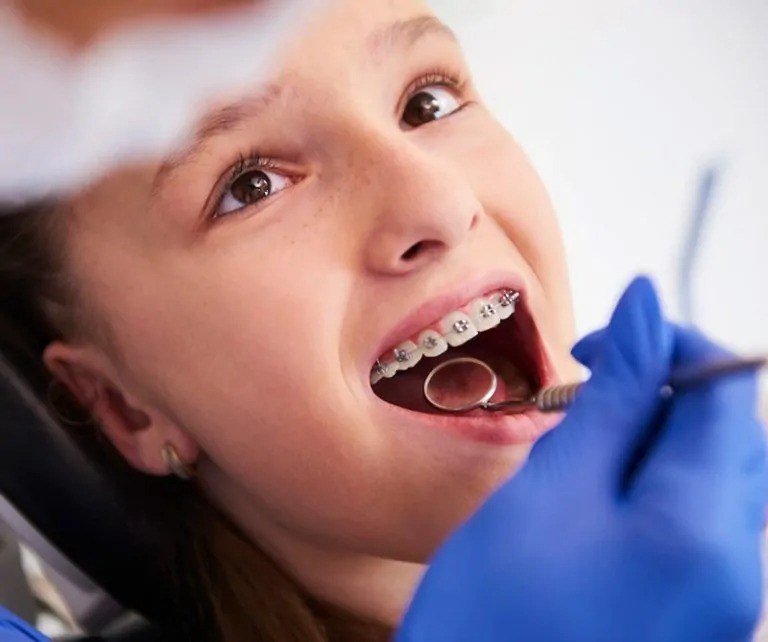 Common Dental Procedures Offered by Family Dentists